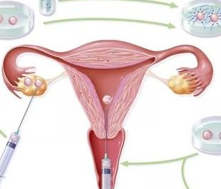 上海试管婴儿医院哪家成功率高呢？